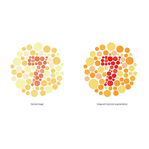 Augmentation des couleurs