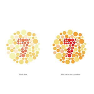 Augmentation des couleurs
